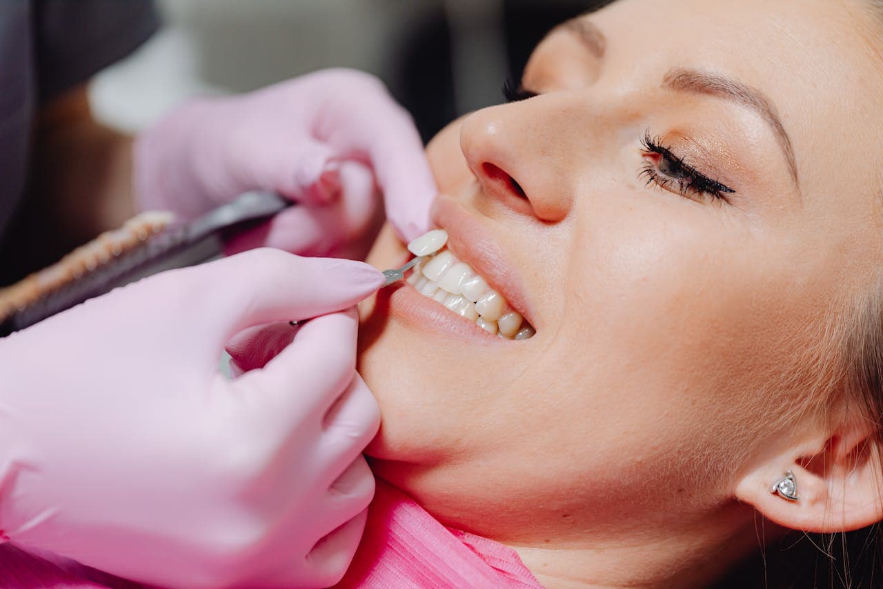 Dentist placing a porcelain veneer against a patient's front teeth for shade matching